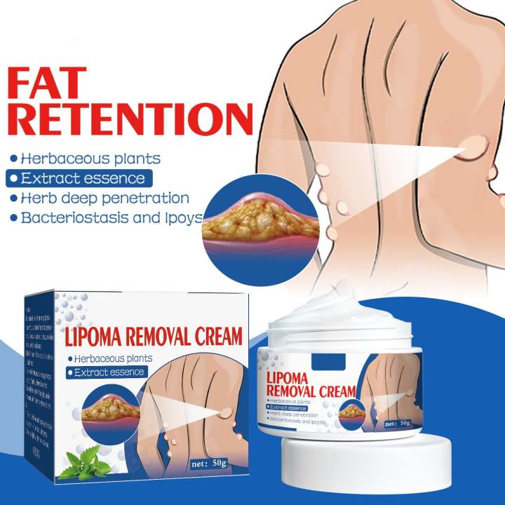 Lipoma Relief Cream