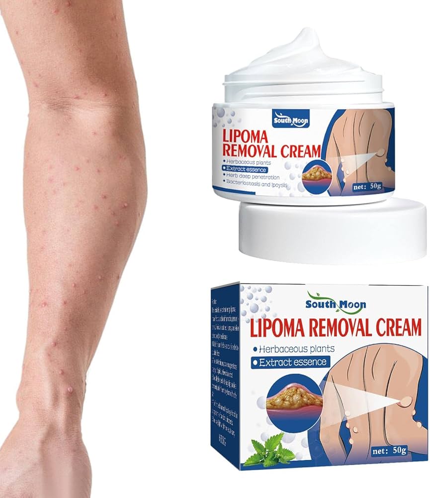 Lipoma Relief Cream