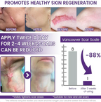 ReGenScar Stem Cell Repair Gel (Visible Scar Improvement in 7 Days) (Buy 1 Get 1 Free)