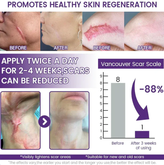 ReGenScar Stem Cell Repair Gel (Visible Scar Improvement in 7 Days) (Buy 1 Get 1 Free)